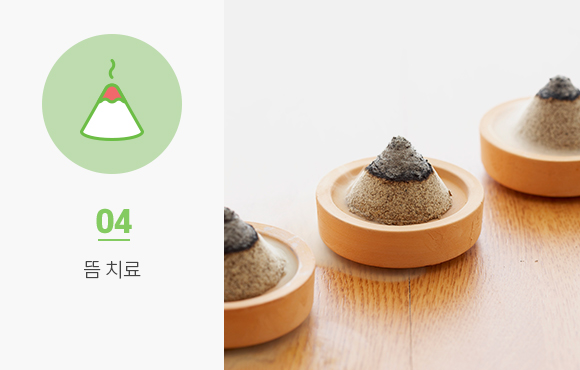 뜸치료
