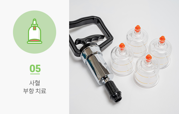 사혈 부항치료